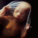эмбрион ребенка мертвый